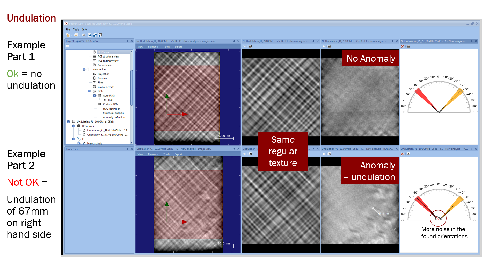 Undulation detection within a 2 layer fabric with a mapping based on eddy current